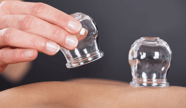 تعرف على أبرز الحالات التي يمكن استخدام الحجامة لعلاجها  ..  ومتى يجب تجنب استخدامها 