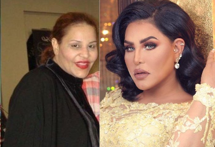 بالصور  ..  شاهد كيف اصبح شكل هؤلاء النجمات بعد التجميل 