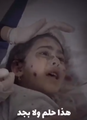 ذهول طفلة من غزة وجدت نفسها جريحة في المستشفى ..  "هذا حلم ولا بجد؟" (فيديو )