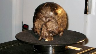 بالصور  ..  أقدم مخ محفوظ في العالم مفتاح لمكافحة مرض خطير  ..  "تفاصيل"