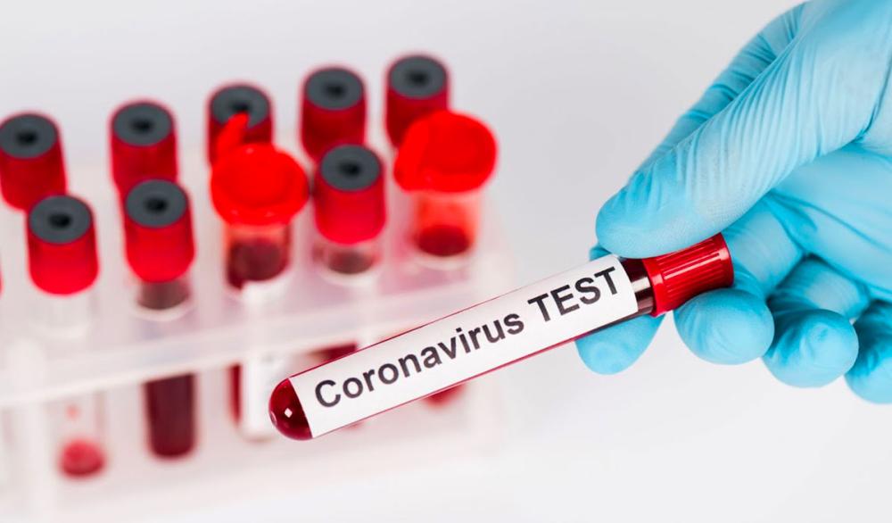  تعافى نصف المصابين بفيروس كورونا المستجد "كوفيد-19" حول العالم