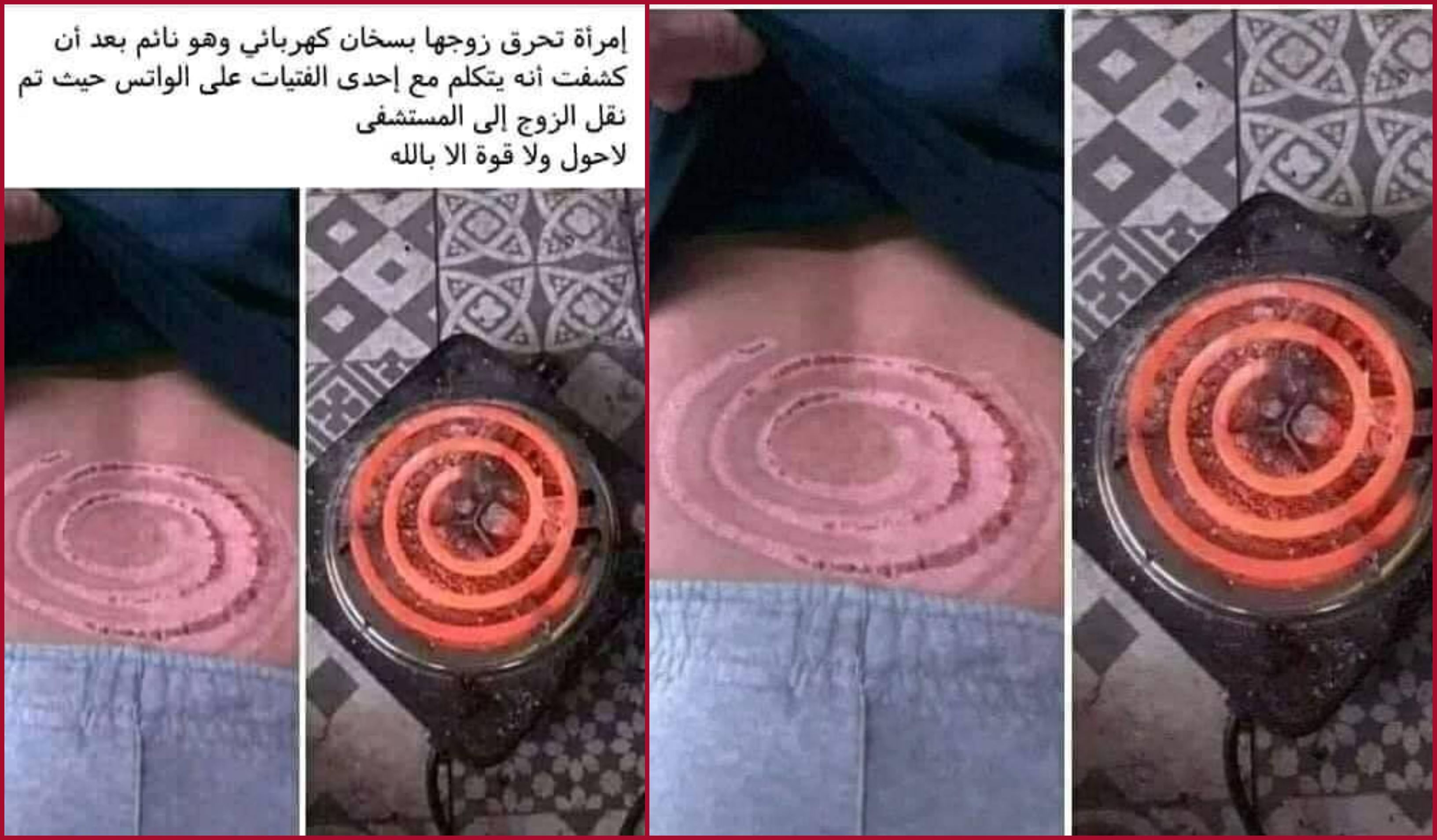 بالصور  ..  حقيقة "حرق" امرأة لزوجها بسخان كهربائي بعدما كشفته يُكلّم فتاة  ..  تفاصيل