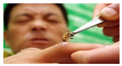 متى يجب استشارة الطبيب بعد لدغات الحشرات ..  علامات ينبغي الانتباه لها