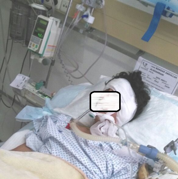  الزرقاء: طعن شاب 3 طعنات بالصدر احداها نافذة في مشاجرة 