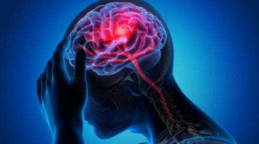 مكون خفي في أطعمتنا يزيد مخاطر الإصابة بسكتة دماغية