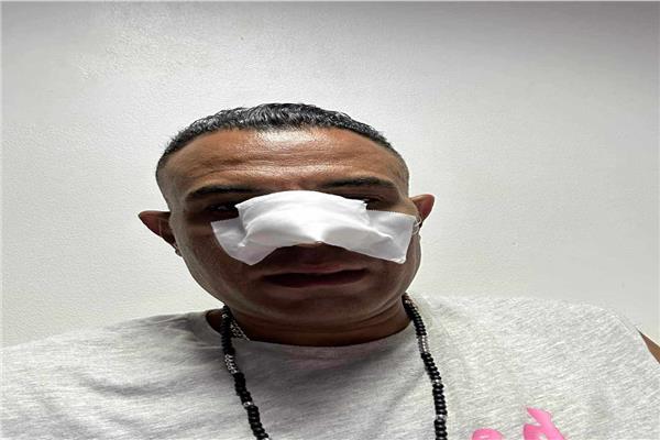 نجا من الموت ..  وكيل أعمال تامر حسني يتعرض لحادث مروع