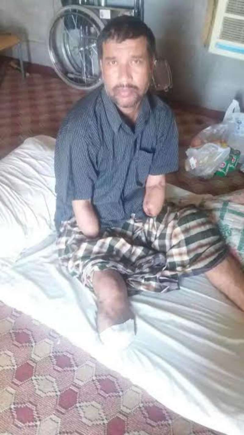 بنجلاديشي يفقد أطرافه الأربعة بالعمل وينتظر صرف مستحقاته منذ 4 أشهر بتبوك