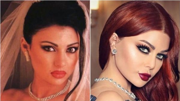 بالأرقام ..  هذا عدد عمليات تجميل النجمات العرب