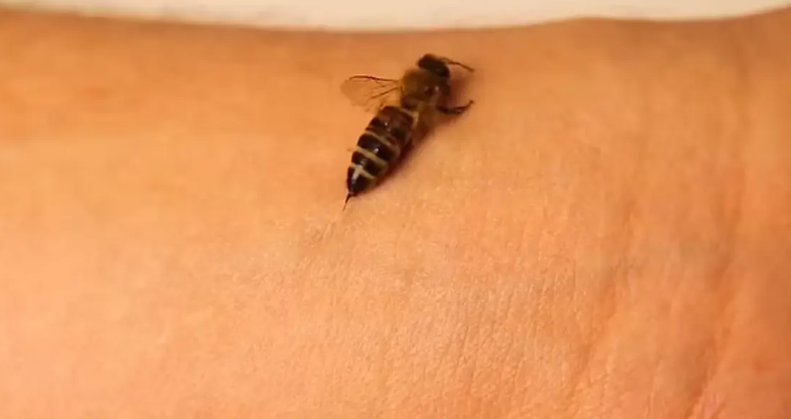 فيديو مرعب ..  شاهد عن قرب ما يحدث عندما تلدغك نحلة