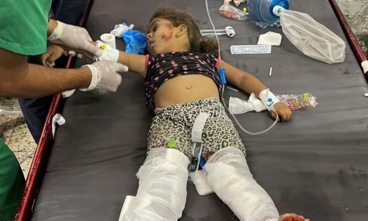 صحة غزة: "إسرائيل" تستخدم أسلحة تسبب حروقا شديدة بأجسام الضحايا