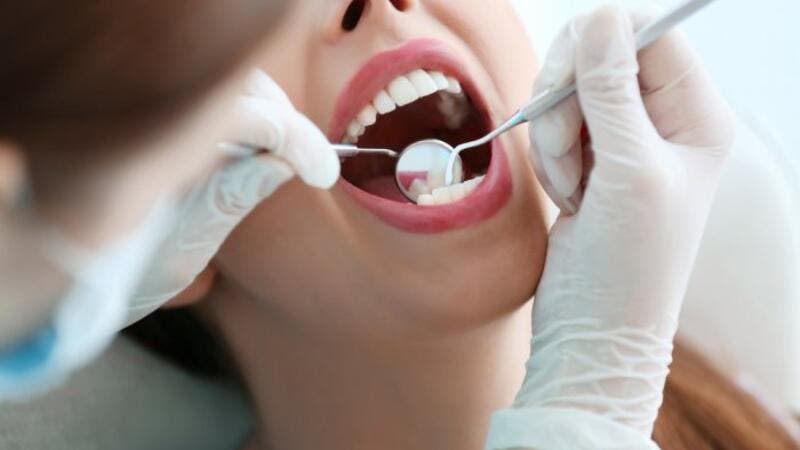 طرق طبيعية لعلاج تسوس الاسنان