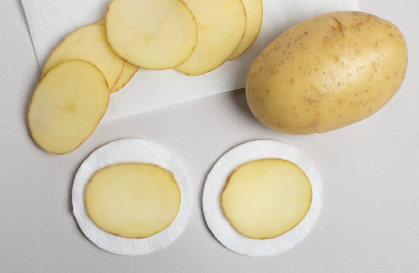 البطاطا ..  "كنز حقيقي" للعناية بالبشرة