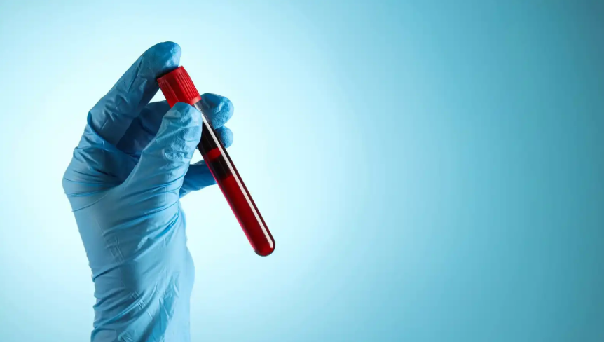 فحص دم يتنبأ بالزهايمر قبل سنوات من ظهور أعراضه