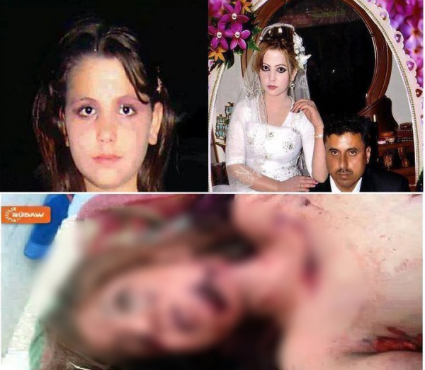 بالصور .. زوج يقطع الاعضاء التناسلية  لزوجته و يقتلع عينها !