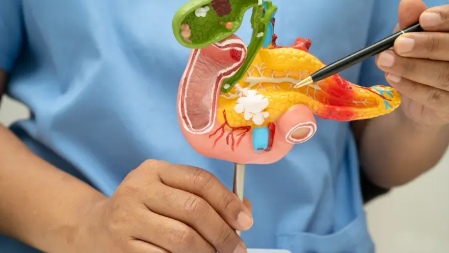 الكشف عن جينات ترتبط بخطر الإصابة بسرطان البنكرياس