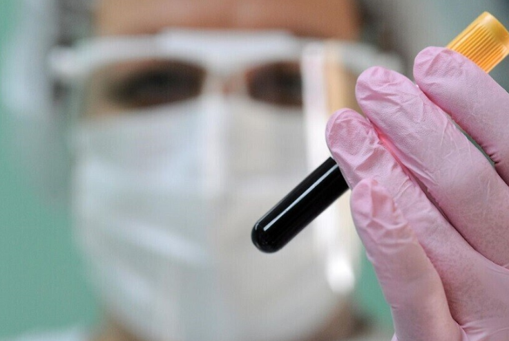 مخاوف من جائحة جديدة بعد اكتشاف فيروس "صامت" يخترق الجهاز التنفسي للبشر