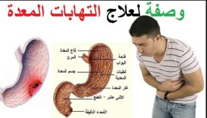 علاج التهاب المعدة ب 10 اعشاب