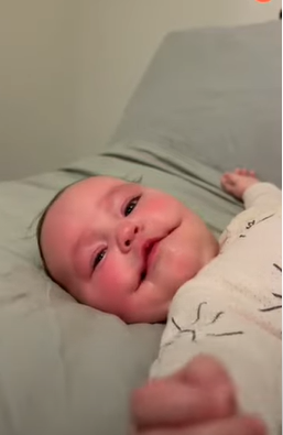 طفلة بمرض نادر في الوجه تحصد 46 مليون مشاهدة ..  فيديو