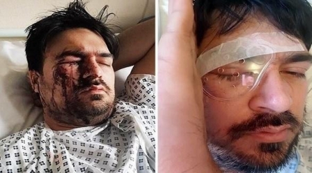 سائق تكسي يفقد بصره جراء تعرضه للضرب من احدى الزبائن 