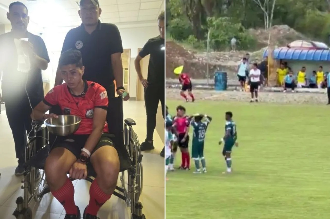 بالفيديو ..  لاعب يرشق حكما مساعدا بحجر في وجهه