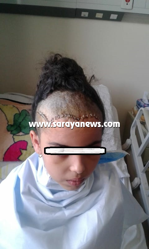 الطفلة "اسيل" تعرضت لحادث تهتك في الجمجمة  ..  تناشد اهل الخير توفير قطعة لتركيبها برأسها  ..  "وثائق"