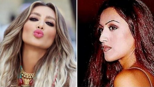 بالصور  ..  من هي الاجمل : فنانات قبل و بعد عمليات التجميل !
