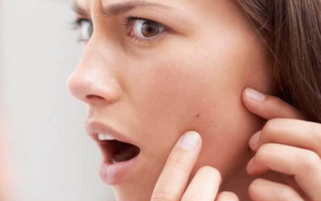 كيف تتوقفين عن العبث بحبوب وجهك؟