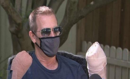 رجل يحذر من مخاطر كورونا : تسبب في بتر أصابع يدي