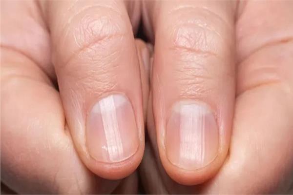 أسرار صحية | الأظافر تكشف الكثير عن تفاصيل جسمك