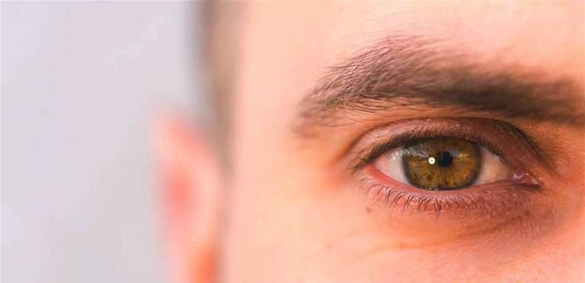 أسباب الحكة في زوايا العين وعلاجها