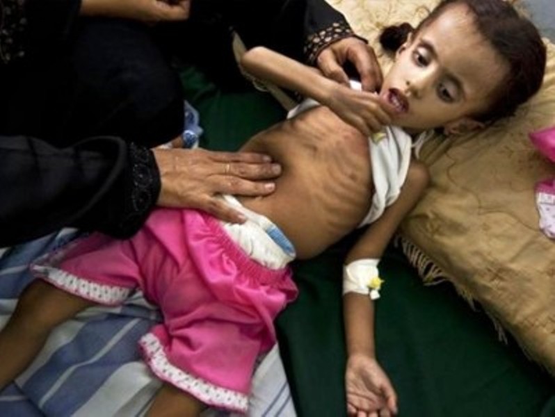 اليمن: الموت يتربص بأطفال وحوامل في مستشفى مهدد بالإغلاق