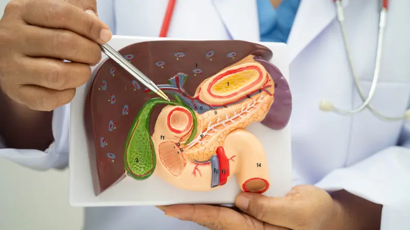 هل يؤثر الصيام على مرضى المرارة في رمضان؟