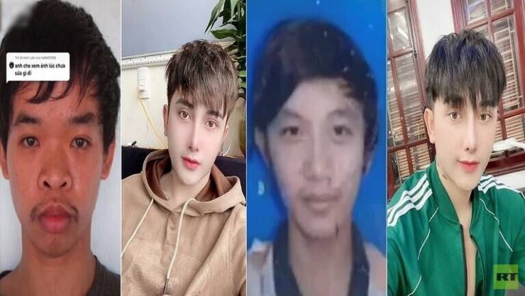 بالصور ..  شاب فيتنامي يجري 9 عمليات تجميل بعد السخرية من شكله خلال مقابلة عمل!