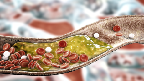 سرّ بسيط لصحة القلب ..  أطعمة تخفض الكوليسترول خلال أسابيع