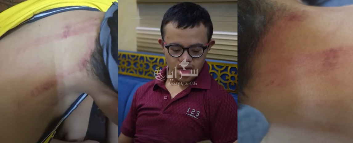 تجمع ذوي الإعاقة الأردني يطالب بمحاسبة المعتدي على طفل من ذوي متلازمة داون - فيديو 