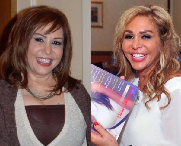 بالصور :عمليات التجميل تشوّه ملامح مهى المصري كلياً… لن تصدقوا كيف أصبحت!  
