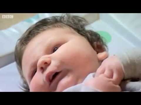 بالفيديو  ..  20 طبيب لولادة أكبر مولود في العالم‎