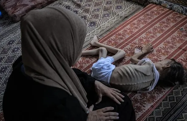 صحة غزة: ارتفاع شهداء التجويع الإسرائيلي إلى 251