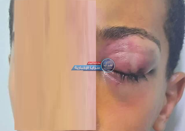 تفاصيل مروعة في حادثة اعتداء معلم على طالب في إربد