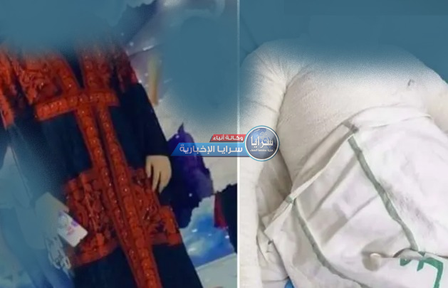 هذا آخر ما قالته الأردنية التي أحرقها زوجها بالكاز قبل وفاتها