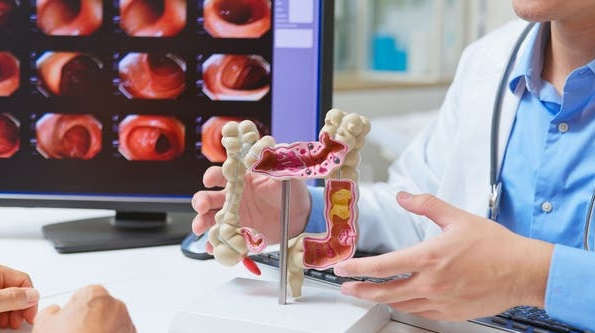 أدوية شائعة للقولون العصبي تحت المجهر