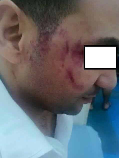 بالفيديو : شقيق نائب يعتدي على وافد مصري يعمل بمطعم في العقبة