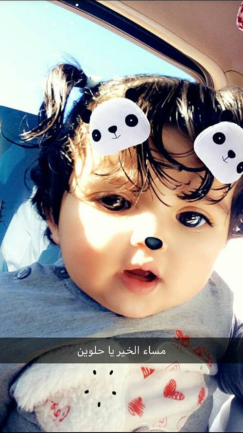 بالصور .. قصة مأساوية لطفلة توقف قلبها 13 مرة!