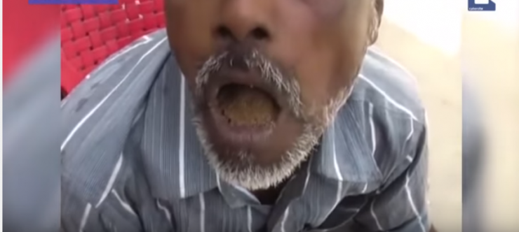 بالفيديو: تعرف على الرجل الذي أدمن على تناول الحجارة!!