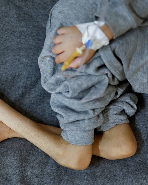 أسرة من 6 أفراد تناشد أهل الخير مساعدة طفلها المريض وتوفير احتياجاته الطبية  - تفاصيل 