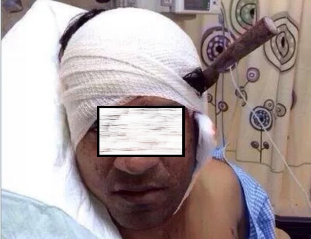  الكرك: عشريني يطعن وافداً في رأسه ويلوذ بالفرار