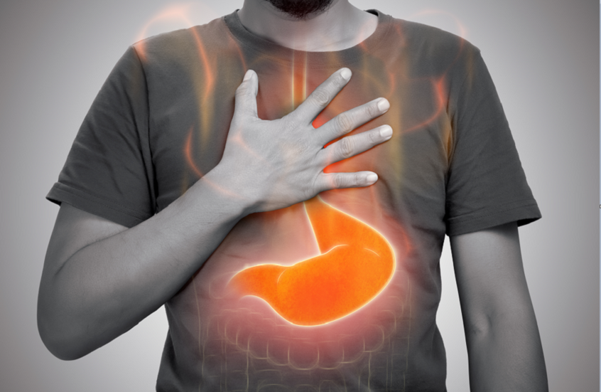 علاقة مقلقة بين الارتجاع الحمضي وصحة القلب