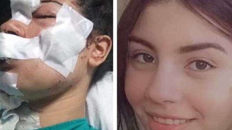 بالصور  ..  بعد أن طعنها وشوه وجهها ..  إسراء عماد تعفو عن زوجها وتعود له!