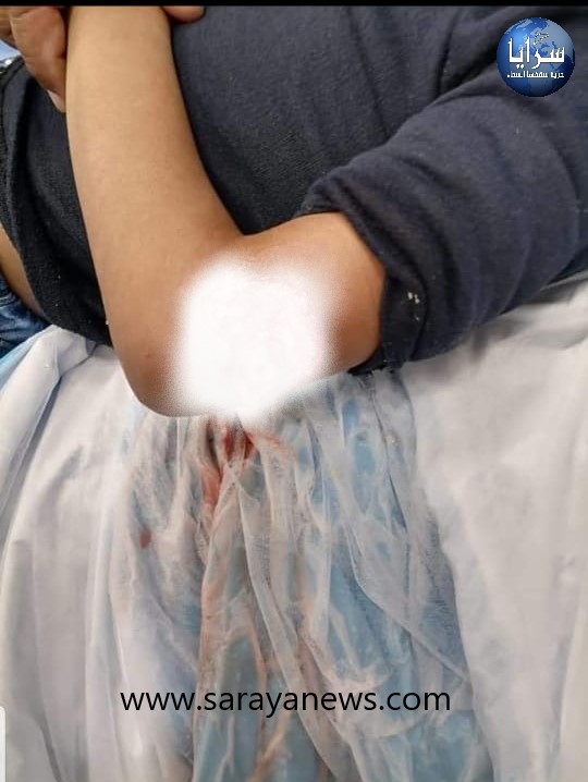 بعد نهش كلب لذراع طفل  ..  ظاهرة الكلاب الضالة تؤرق نوم وسلامة الأردنيين في عدة مناطق في المملكة 