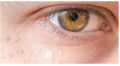 مشكلات صحة العين في 2025 نتيجة نمط الحياة الحديث وسبل الوقاية